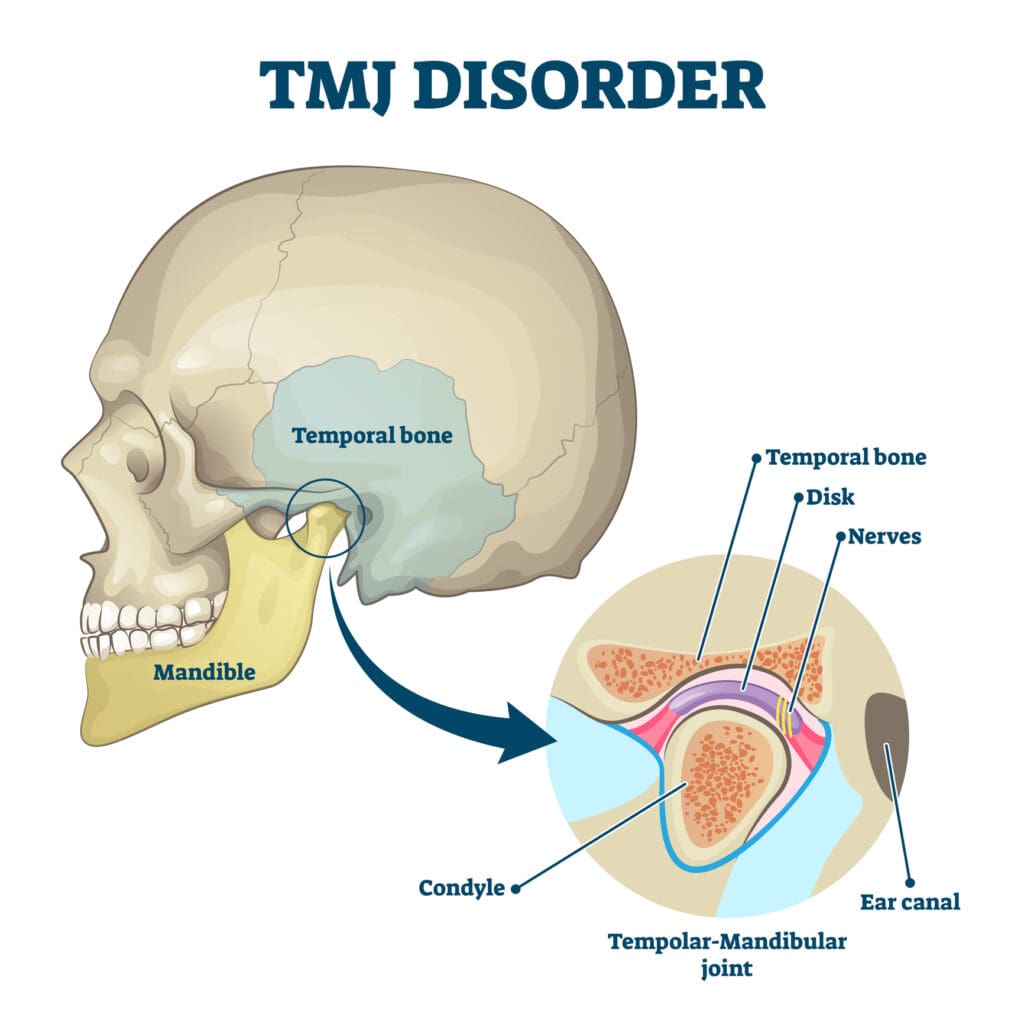 dentist in new orleans for tmj treatment 