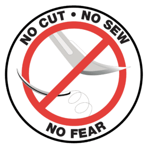 lanap laser gum treatment in new orleans